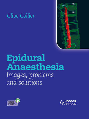 cover image of Epidural Anaesthesia